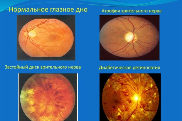 Не могу зайти на кракен